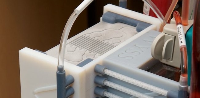 Harvard porta la milza in un chip Harvard porta la milza in un chip