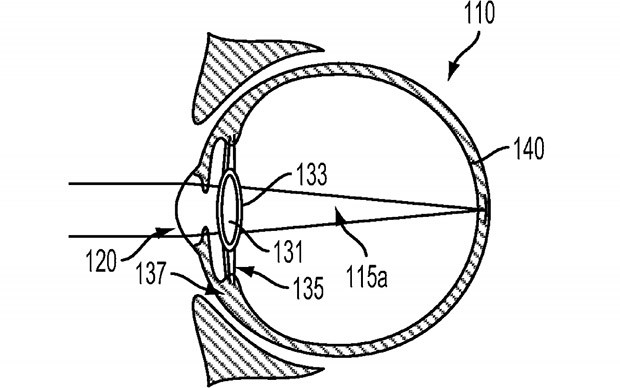 Un'immagine dal brevetto "Intra-Ocular Device" depositato da Google